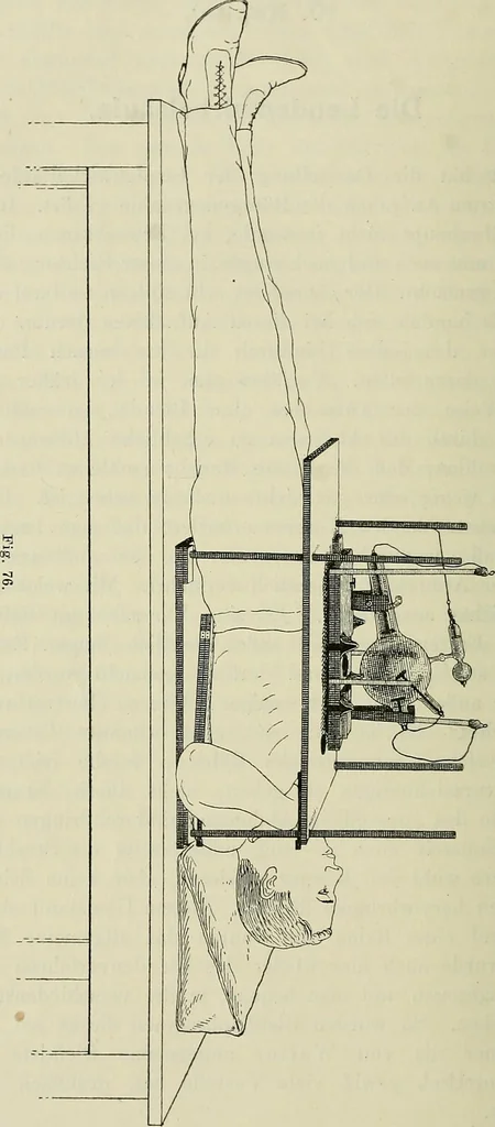 An illustration from Die Röntgentechnik : Lehrbuch für Ärzte und Studierende, 1906, leaf 235