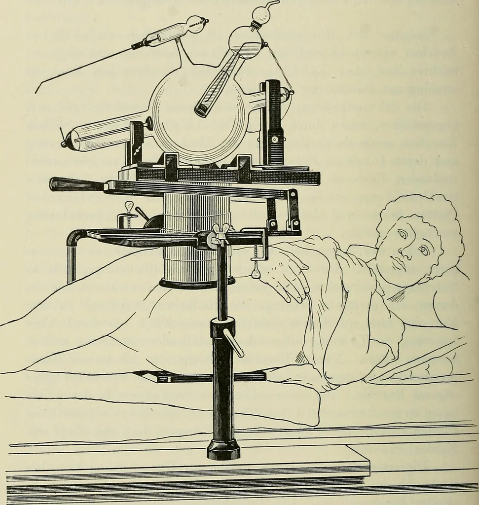 An illustration from Die Röntgentechnik : Lehrbuch für Ärzte und Studierende, 1906, leaf 245