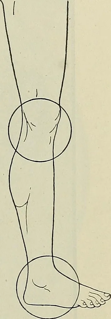 An illustration from Die Röntgentechnik : Lehrbuch für Ärzte und Studierende, 1906, leaf 262