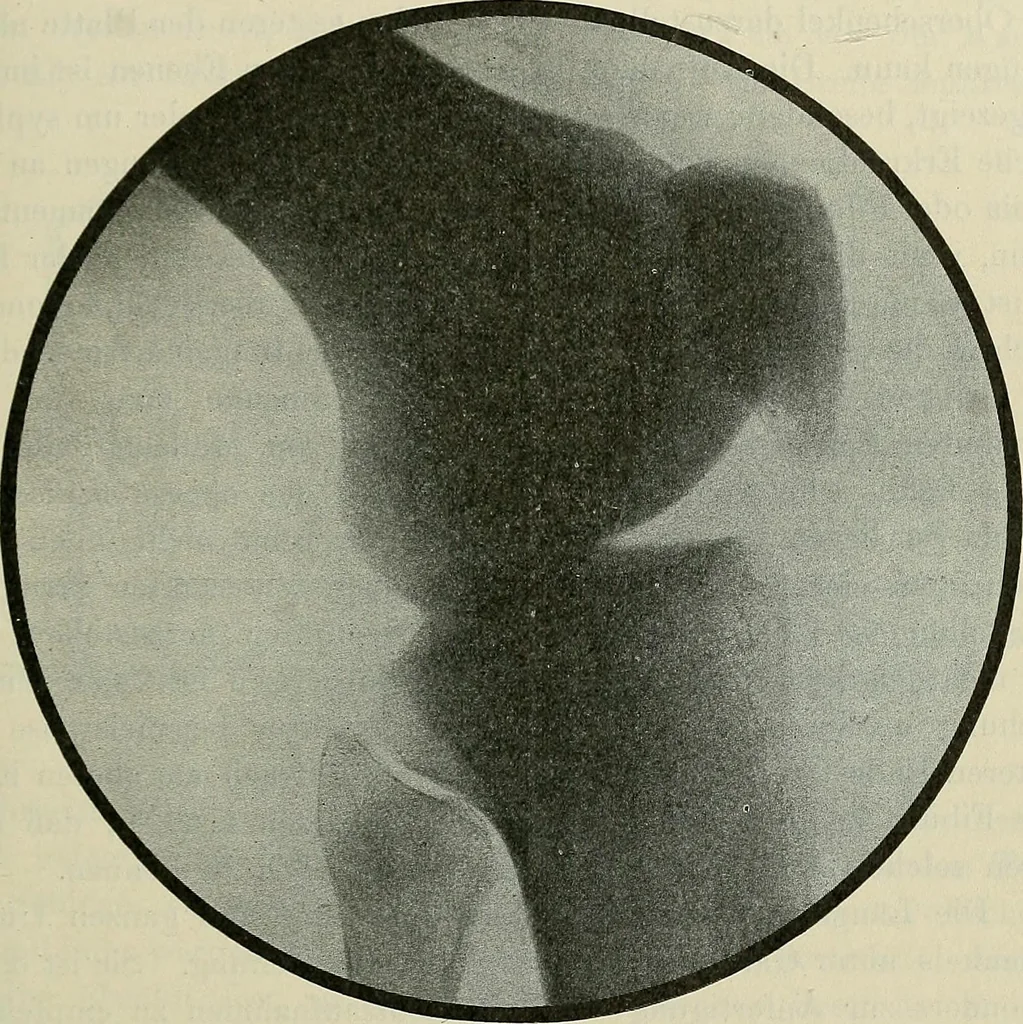 An illustration from Die Röntgentechnik : Lehrbuch für Ärzte und Studierende, 1906, leaf 264