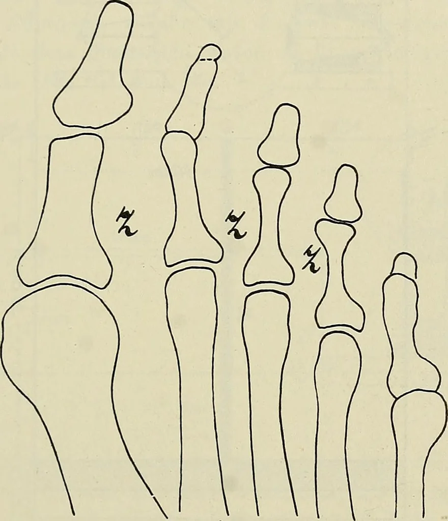 An illustration from Die Röntgentechnik : Lehrbuch für Ärzte und Studierende, 1906, leaf 274