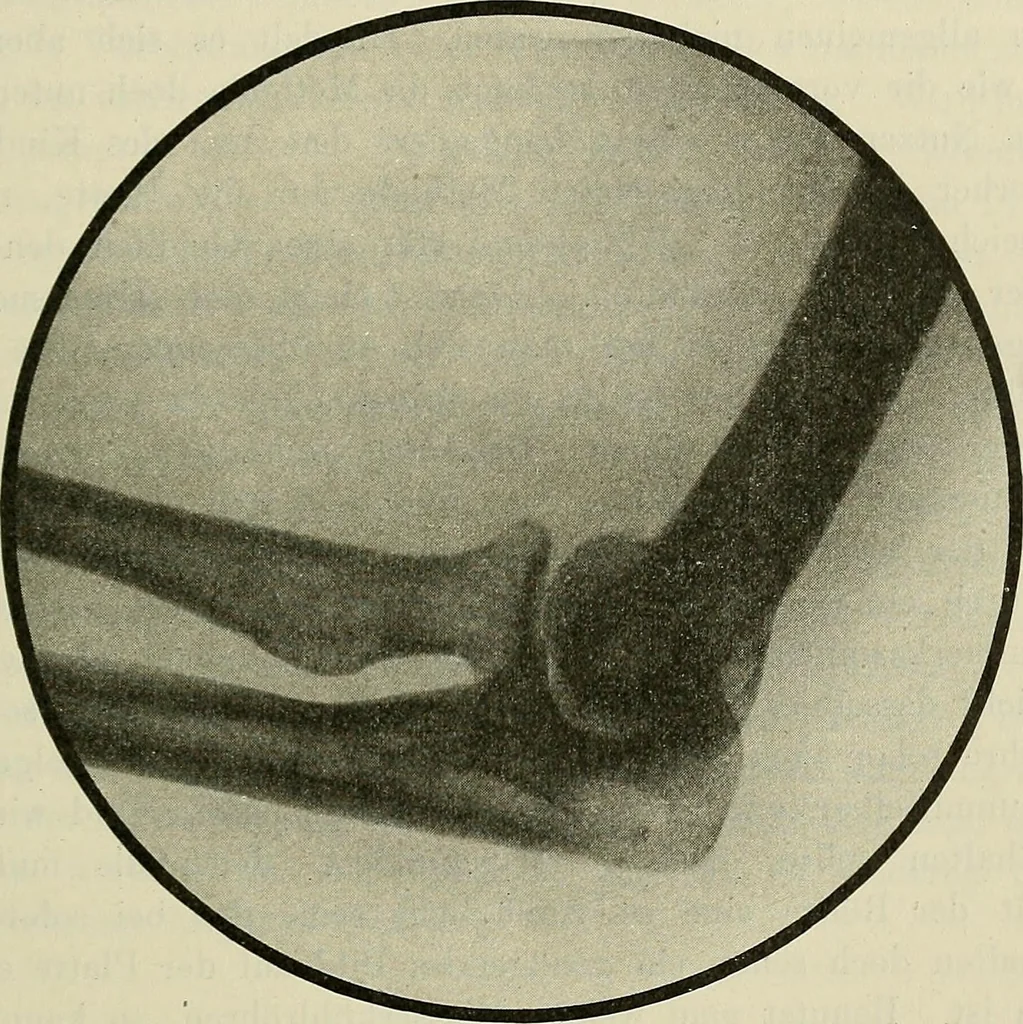 An illustration from Die Röntgentechnik : Lehrbuch für Ärzte und Studierende, 1906, leaf 292
