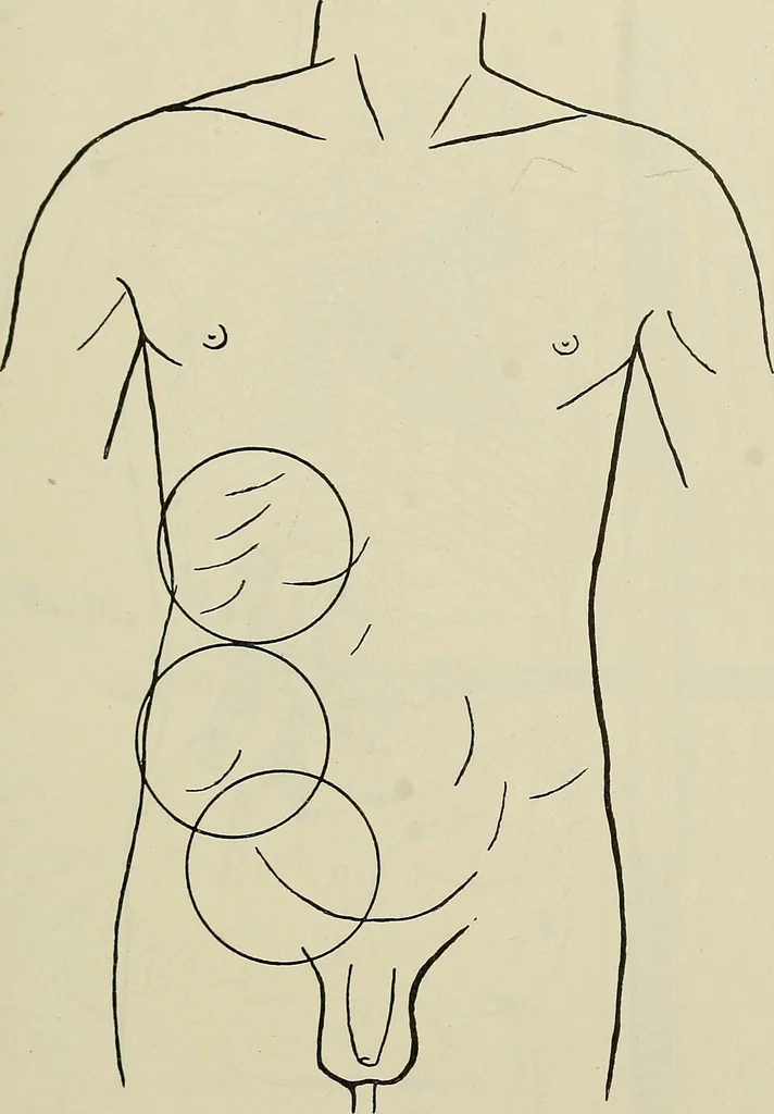 An illustration from Die Röntgentechnik : Lehrbuch für Ärzte und Studierende, 1906, leaf 306