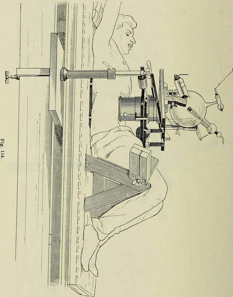 An illustration from Die Röntgentechnik : Lehrbuch für Ärzte und Studierende, 1906, leaf 309