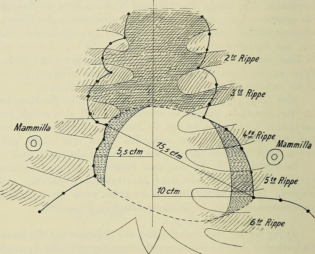 An illustration from Die Röntgentechnik : Lehrbuch für Ärzte und Studierende, 1906, leaf 407