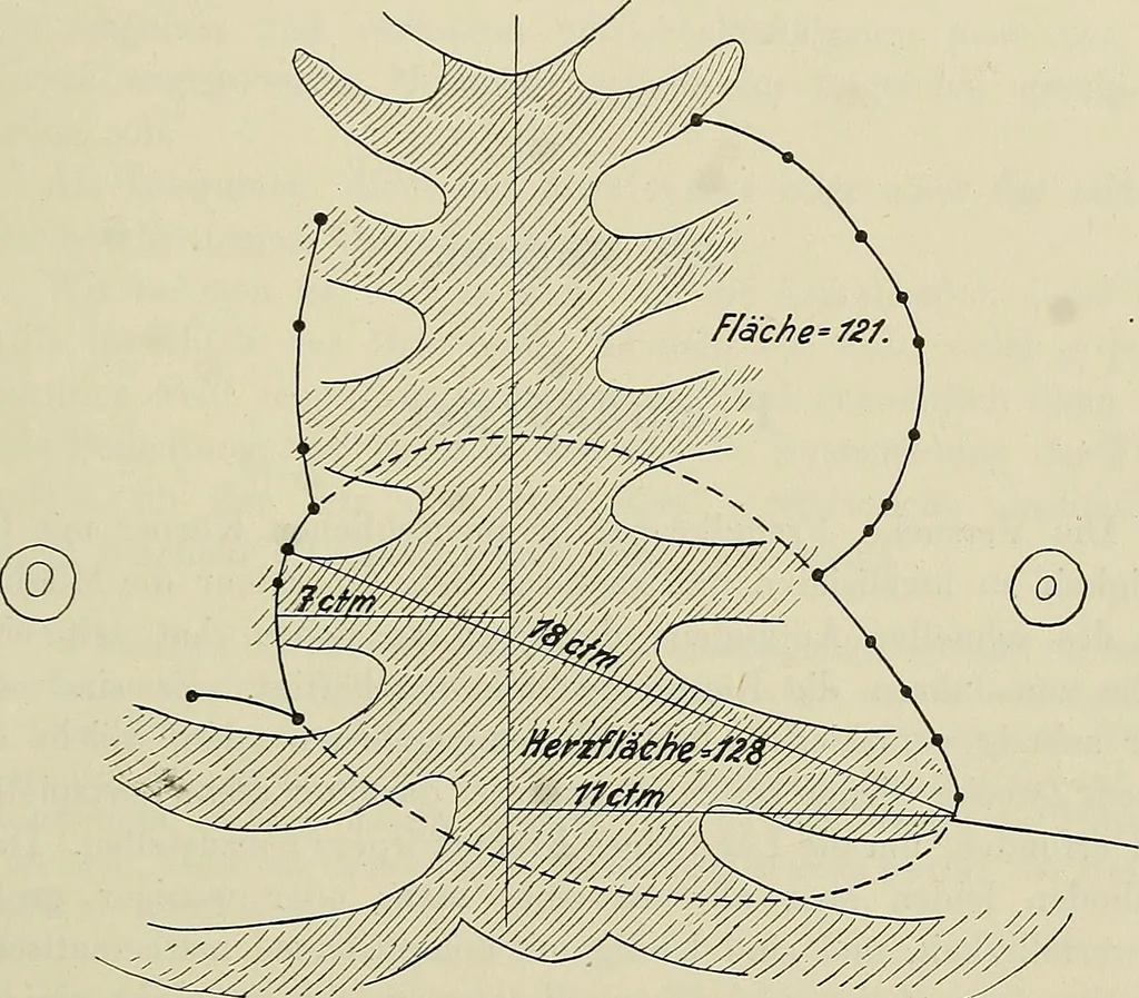 An illustration from Die Röntgentechnik : Lehrbuch für Ärzte und Studierende, 1906, leaf 408