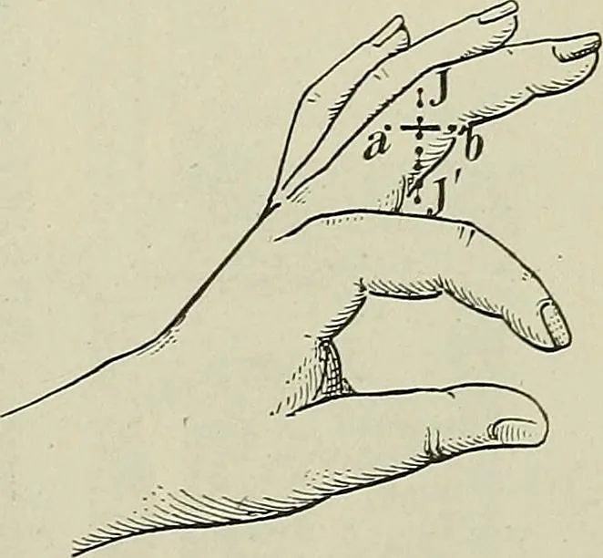 An illustration from Die Röntgentechnik : Lehrbuch für Ärzte und Studierende, 1906, leaf 414