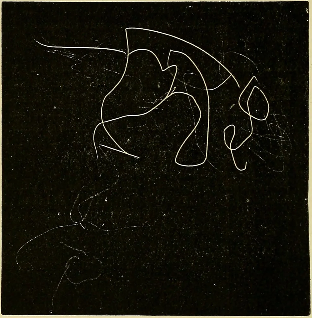 An illustration from Die Suggestion und ihre Heilwirkung, 1888, leaf 363