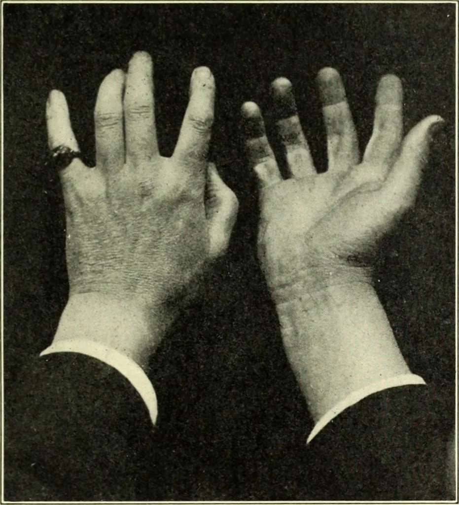 An illustration from The digressions of V., written for his own fun and that of his friends, 1910, leaf 451
