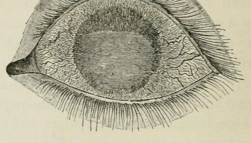 An illustration from Diseases of the eye., 1890, leaf 146