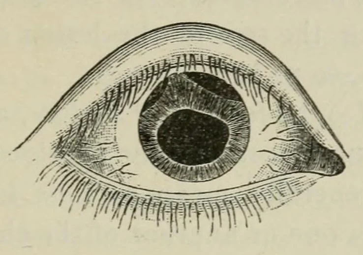 An illustration from Diseases of the eye., 1890, leaf 181