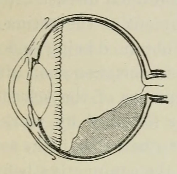 An illustration from Diseases of the eye., 1890, leaf 237