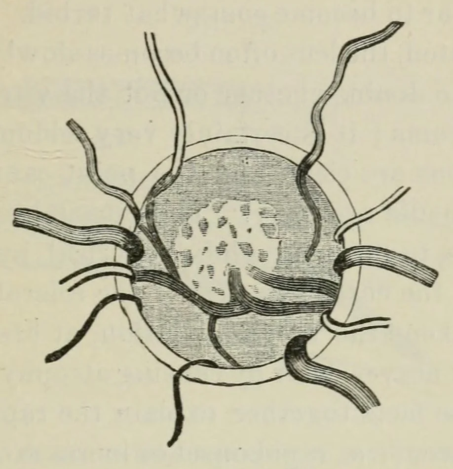 An illustration from Diseases of the eye., 1890, leaf 295