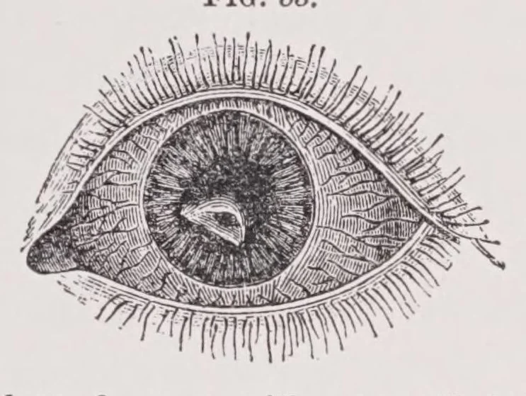 An illustration from Diseases of the eye, 1900, leaf 141