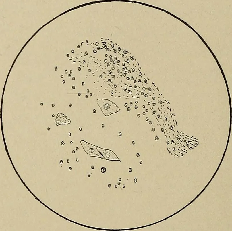 An illustration from Diseases of the stomach : a text-book for practitioners and students, 1906, leaf 120
