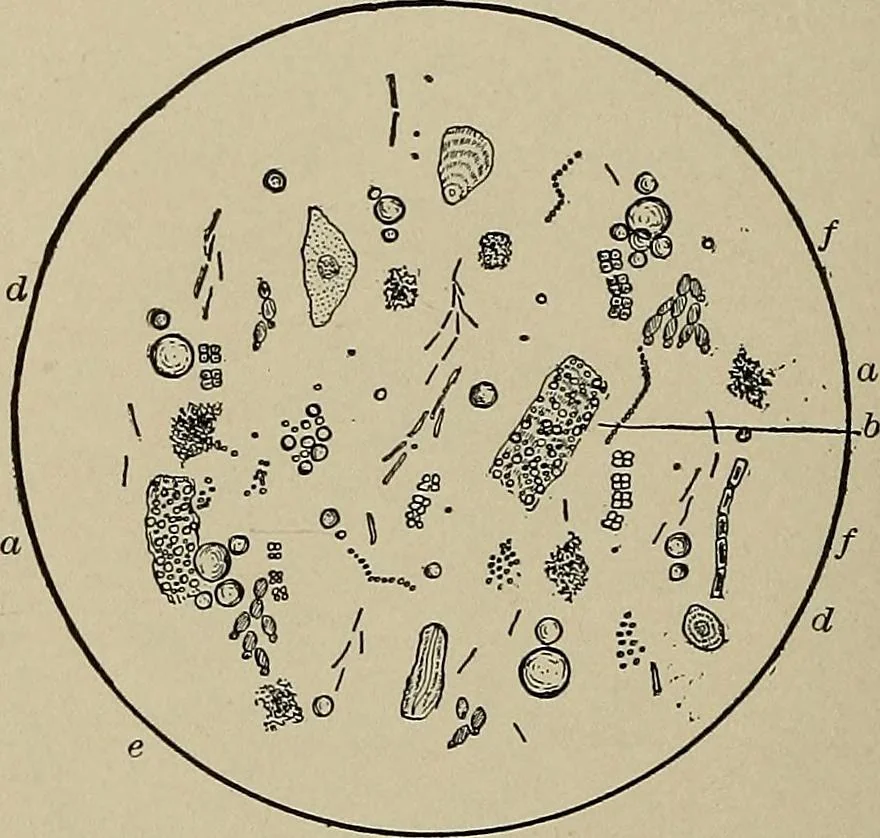 An illustration from Diseases of the stomach : a text-book for practitioners and students, 1906, leaf 122