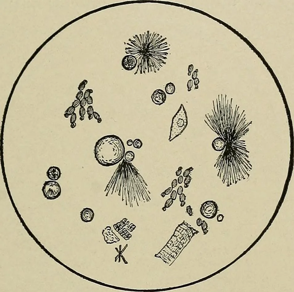 An illustration from Diseases of the stomach : a text-book for practitioners and students, 1906, leaf 123