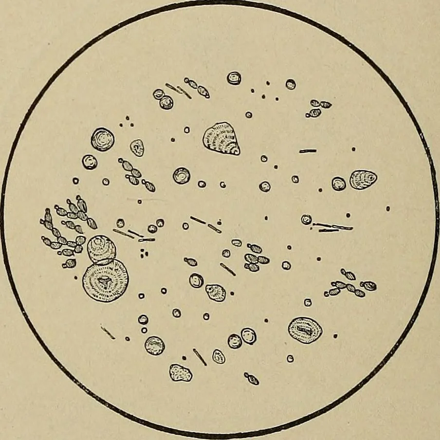 An illustration from Diseases of the stomach : a text-book for practitioners and students, 1906, leaf 124