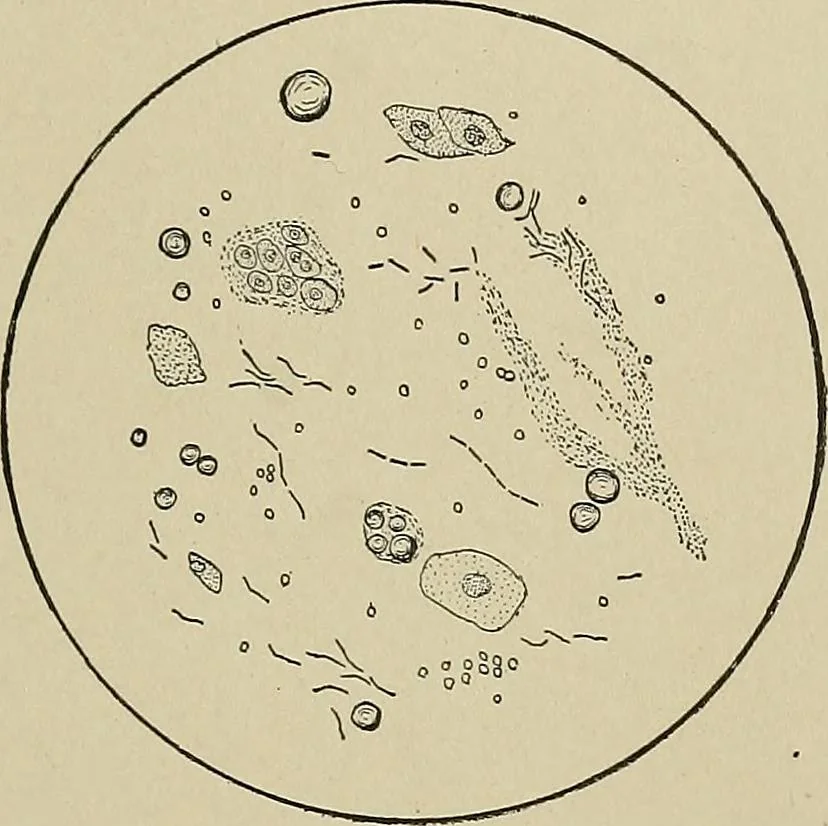 An illustration from Diseases of the stomach : a text-book for practitioners and students, 1906, leaf 125