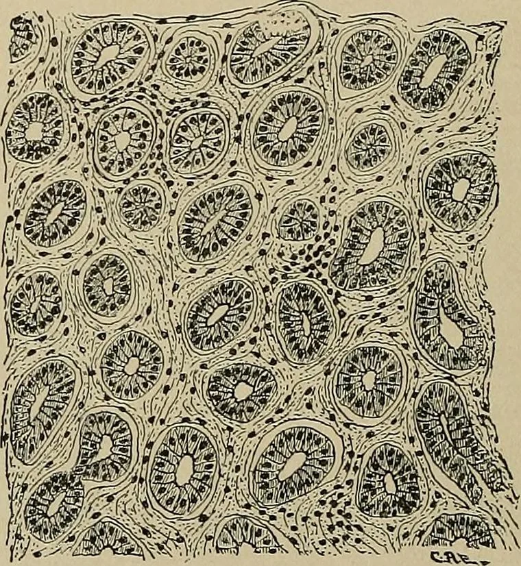 An illustration from Diseases of the stomach : a text-book for practitioners and students, 1906, leaf 132
