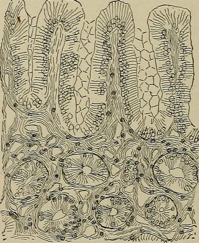An illustration from Diseases of the stomach : a text-book for practitioners and students, 1906, leaf 134