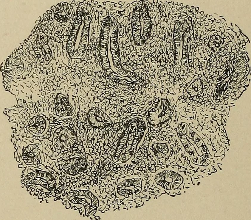 An illustration from Diseases of the stomach : a text-book for practitioners and students, 1906, leaf 136