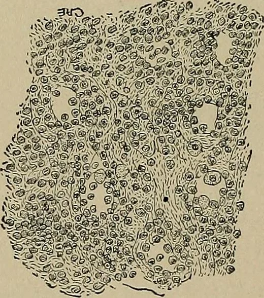 An illustration from Diseases of the stomach : a text-book for practitioners and students, 1906, leaf 136