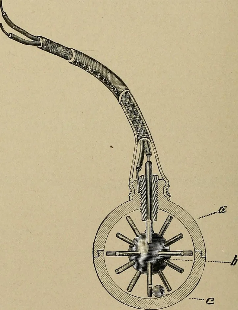 An illustration from Diseases of the stomach : a text-book for practitioners and students, 1906, leaf 148