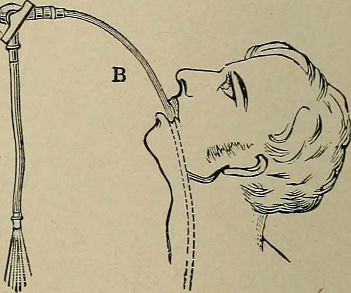 An illustration from Diseases of the stomach : a text-book for practitioners and students, 1906, leaf 186