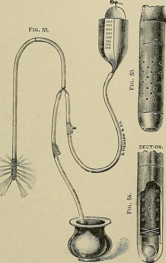 An illustration from Diseases of the stomach : a text-book for practitioners and students, 1906, leaf 193