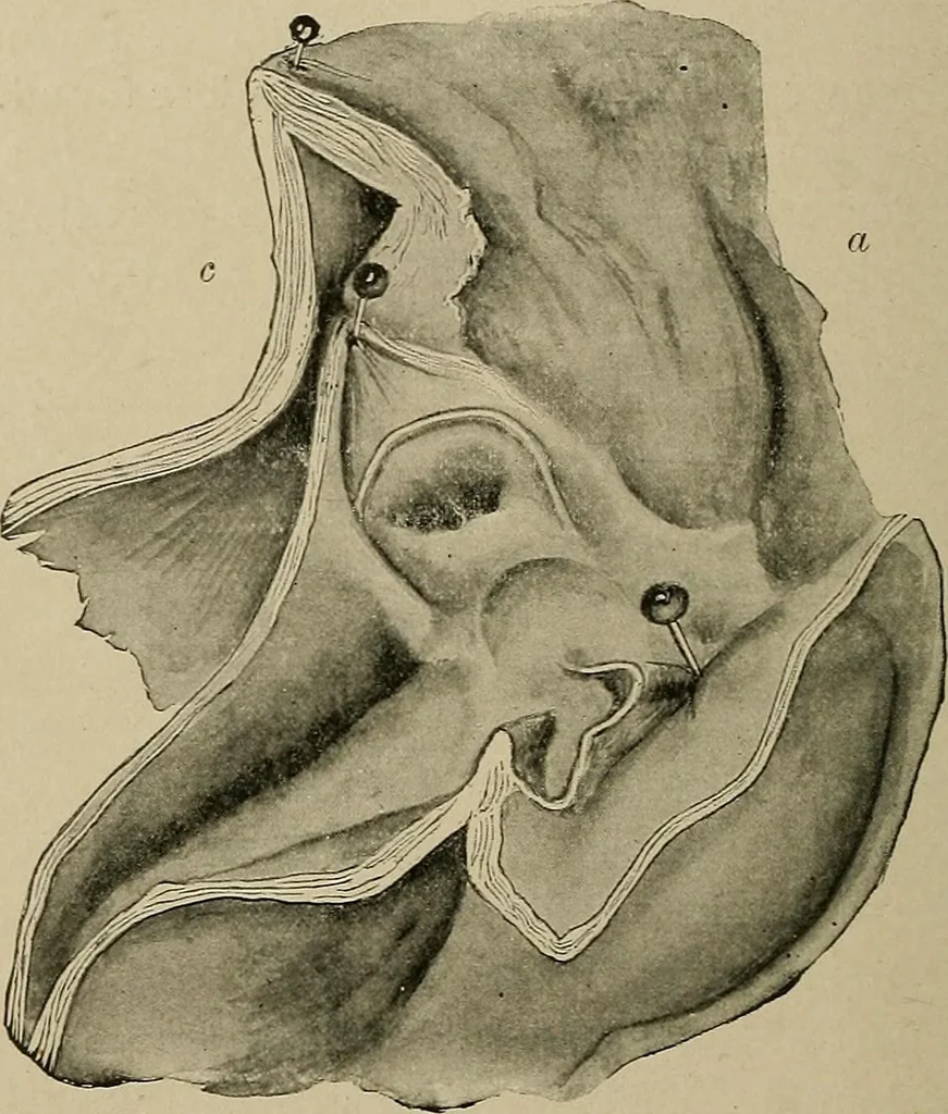 An illustration from Diseases of the stomach : a text-book for practitioners and students, 1906, leaf 262