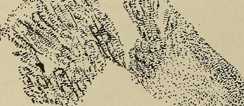 An illustration from Diseases of the stomach : a text-book for practitioners and students, 1906, leaf 264