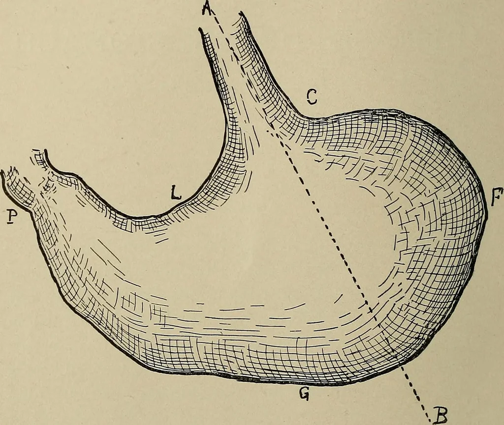 An illustration from Diseases of the stomach : a text-book for practitioners and students, 1906, leaf 28