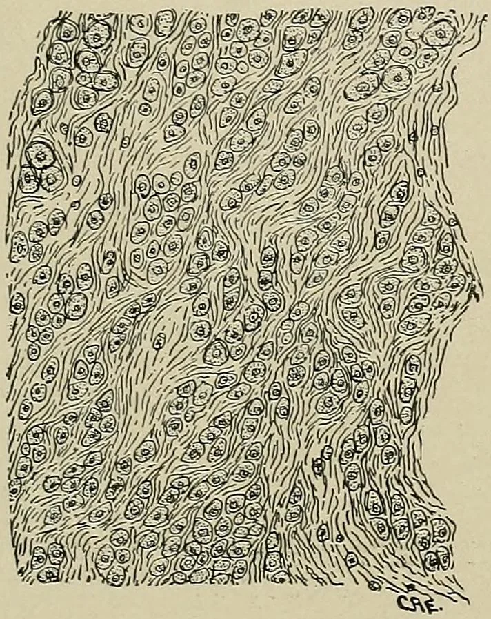 An illustration from Diseases of the stomach : a text-book for practitioners and students, 1906, leaf 327