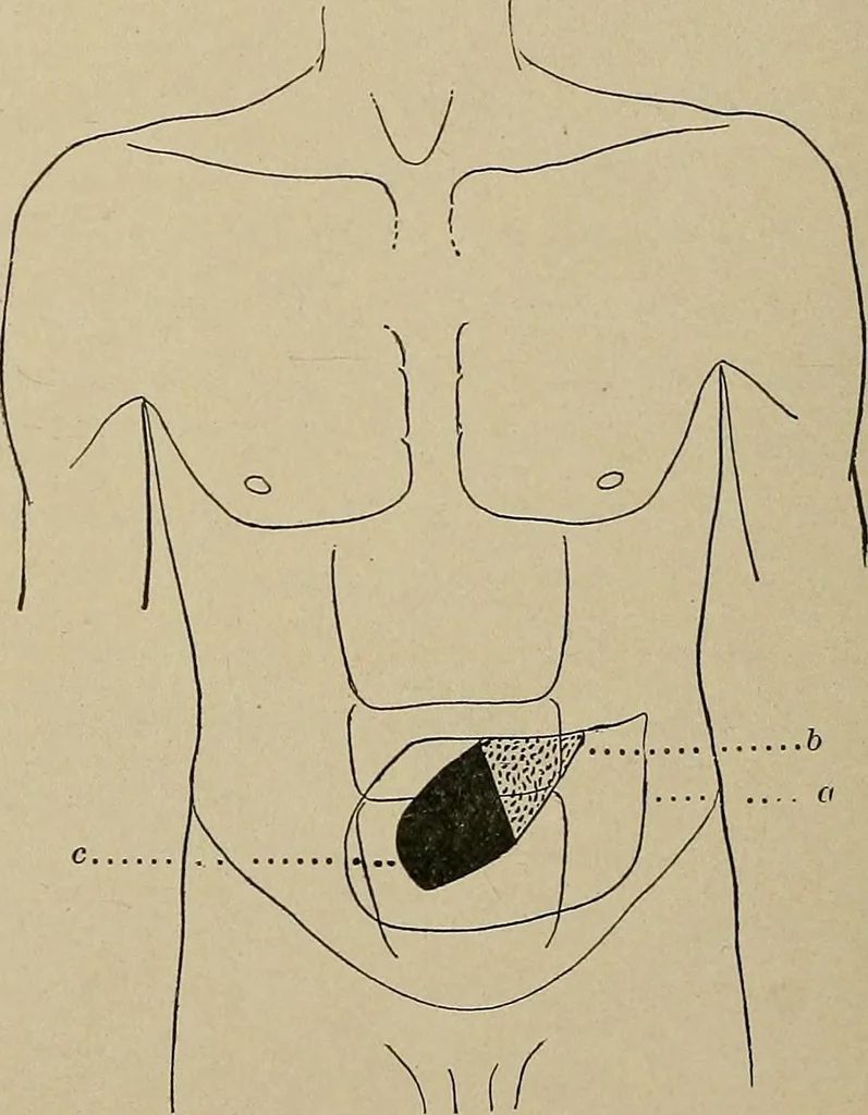 An illustration from Diseases of the stomach : a text-book for practitioners and students, 1906, leaf 436