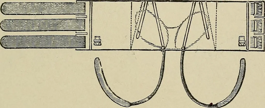 An illustration from Diseases of the stomach : a text-book for practitioners and students, 1906, leaf 473
