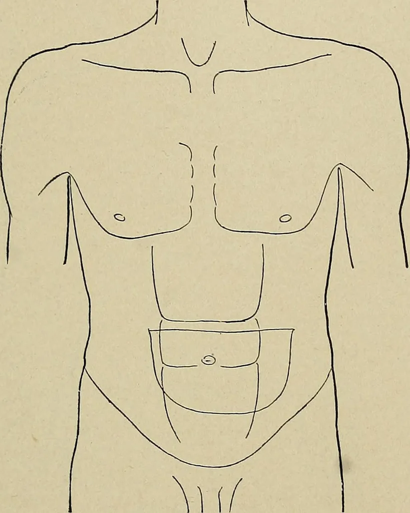 An illustration from Diseases of the stomach : a text-book for practitioners and students, 1906, leaf 69