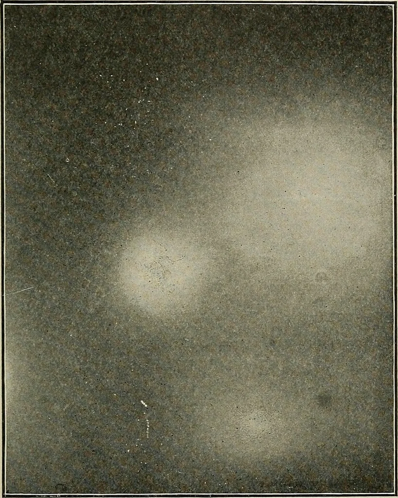 An illustration from Diseases of the stomach : a text-book for practitioners and students, 1906, leaf 83