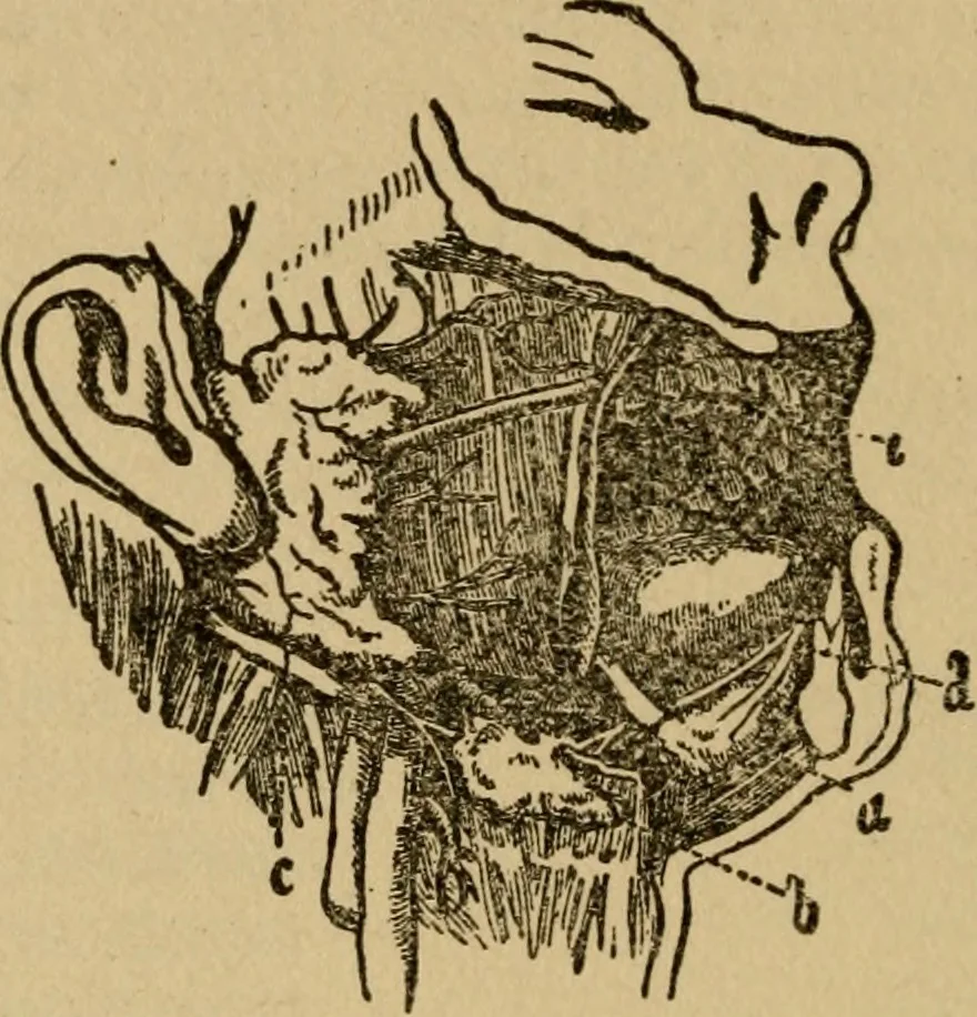 An illustration from Domestic science, a text in cooking and syllabus in sewing, prepared for use in the Kansas City elementary schools, yet eminently fitted for home work, 1911, leaf 99