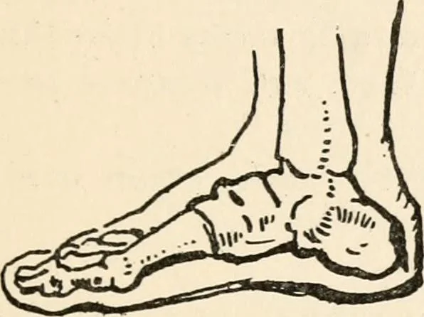 An illustration from Drawing for beginners, 1920, leaf 81