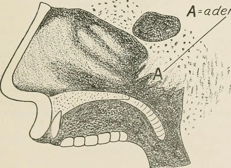 An illustration from Physical education complete for schools and playgrounds, 1917, leaf 286