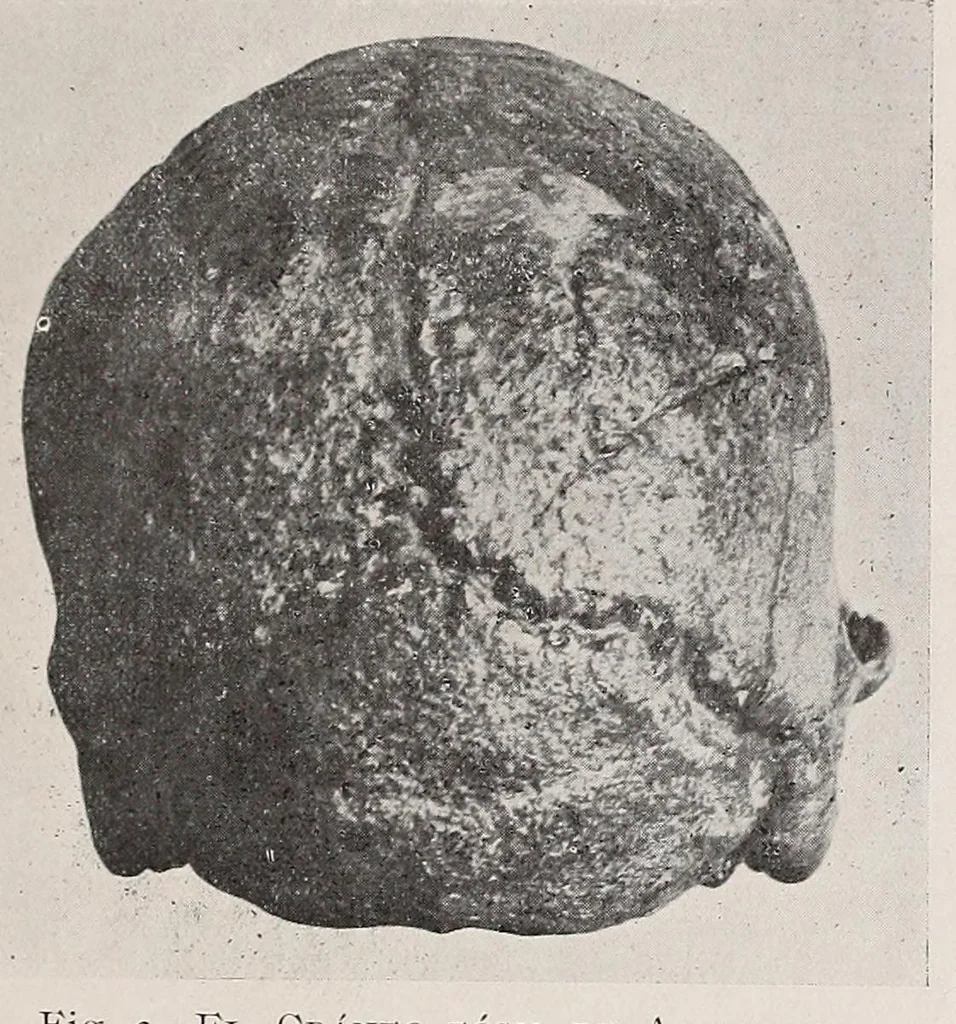 An illustration from El cráneo fósil de Arrecifes : (Provincia de Buenos Aires) : atribuído a la formación pampeana superior, 1907, leaf 19