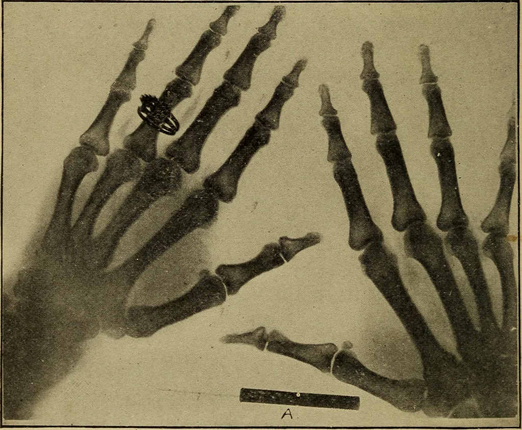 An illustration from Electricity and its recent applications, 1902, leaf 252