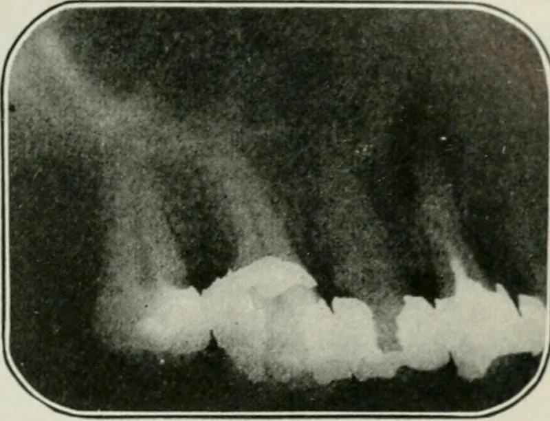 An illustration from An elementary book on electricity and magnetism and their applications, 1919, leaf 646