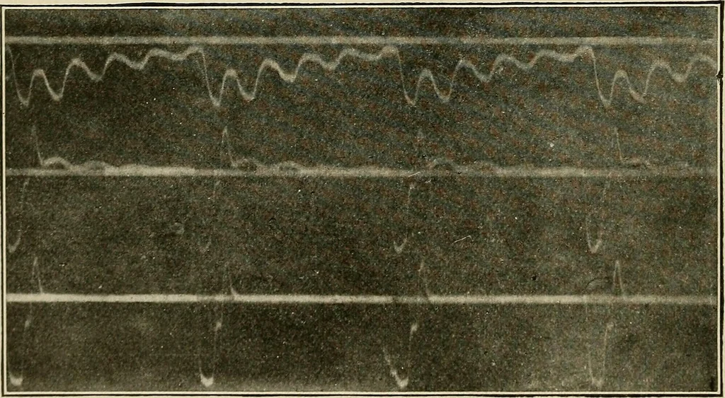An illustration from Elementary lectures on electric discharges, waves and impulses, and other transients, 1914, leaf 140