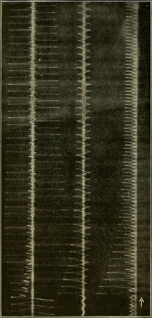 An illustration from Elementary lectures on electric discharges, waves and impulses, and other transients, 1914, leaf 66