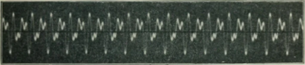 An illustration from An elementary manual of radiotelegraphy and radiotelephony for students and operators, 1916, leaf 349