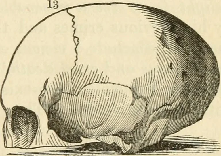An illustration from Elements of phrenology, 1850, leaf 107