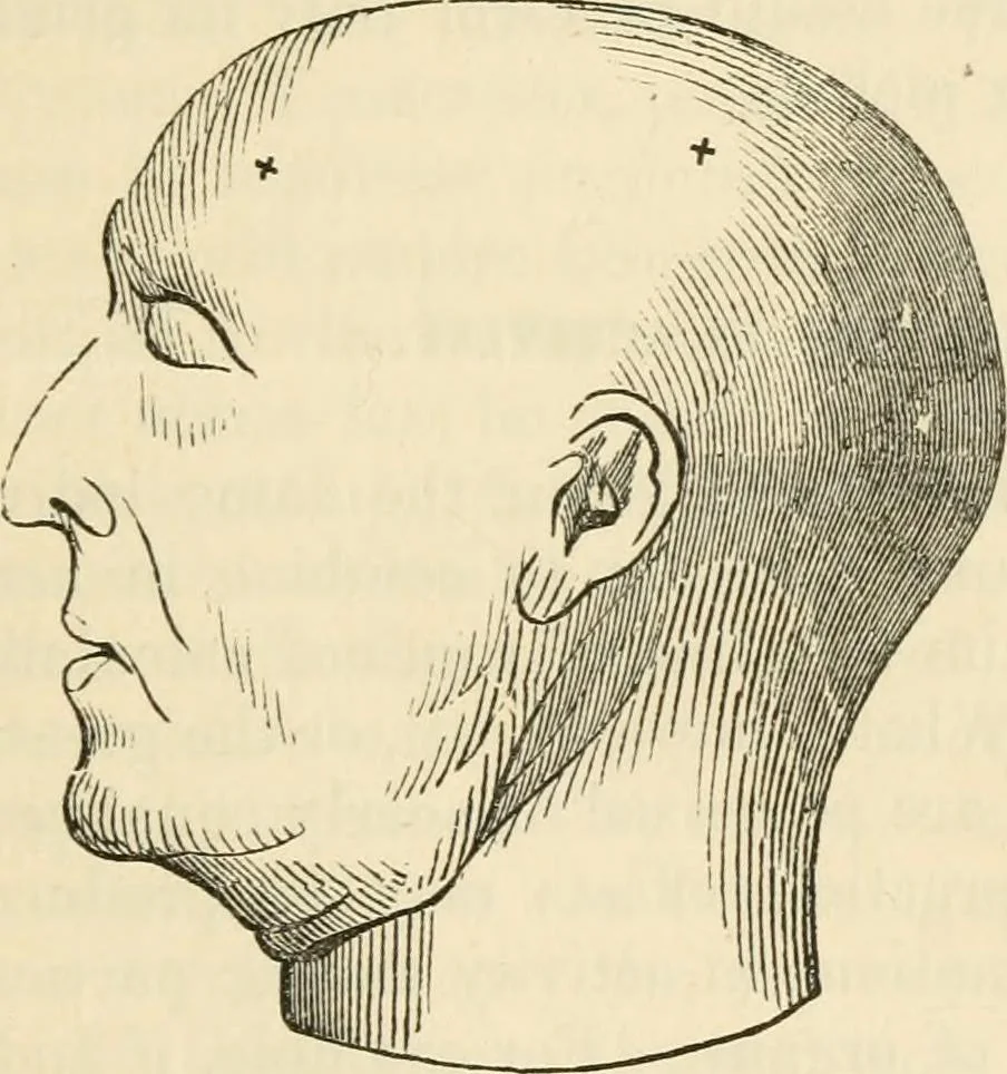 An illustration from Elements of phrenology, 1850, leaf 203