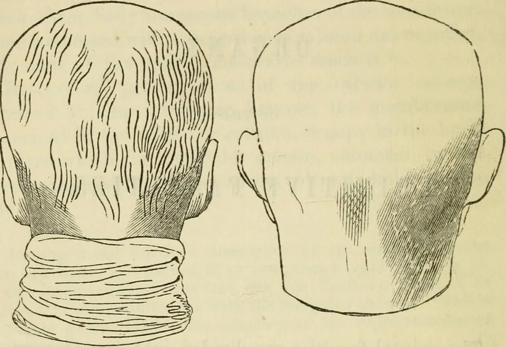 An illustration from Elements of phrenology, 1850, leaf 76